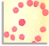 Globules rouges infectés